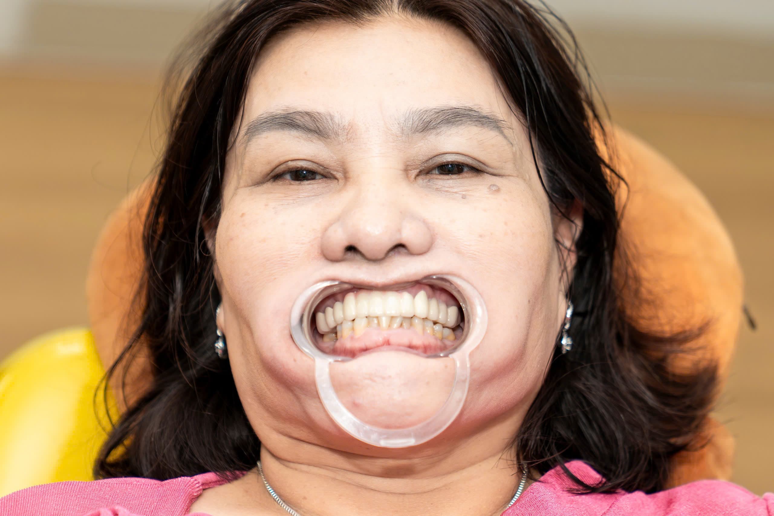 Trước điều trị