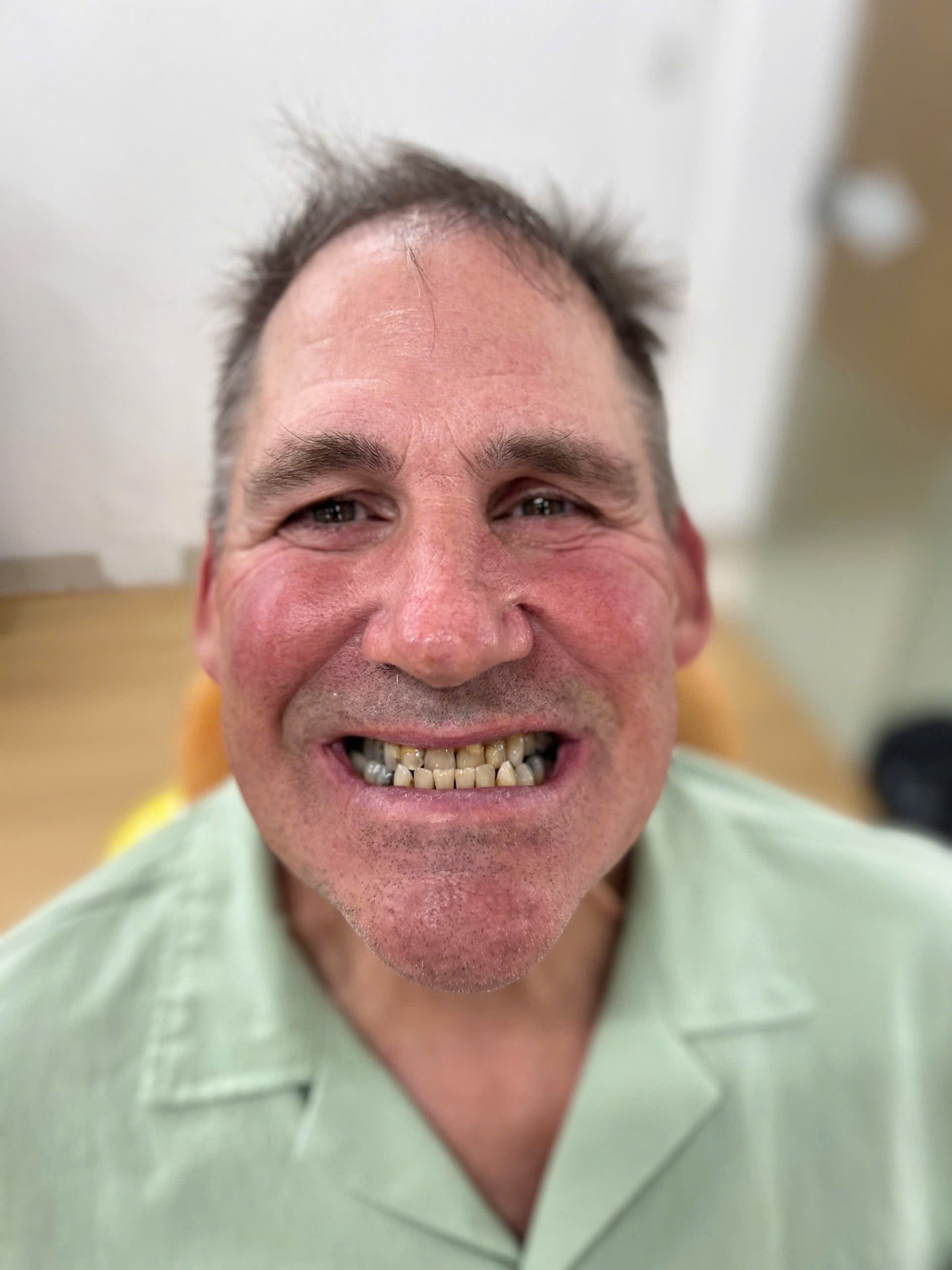 Trước điều trị